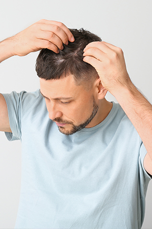 young man touching his thinning hair