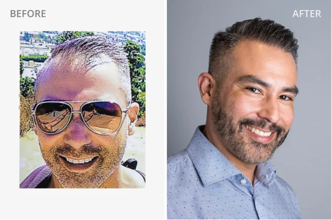 Edgar S. Before and After