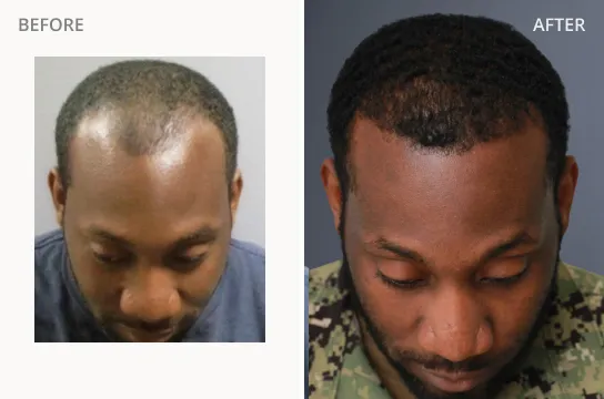 Raynard M. Before and After
