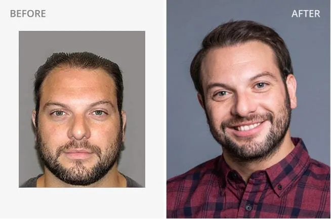 Ryan I. Before and After