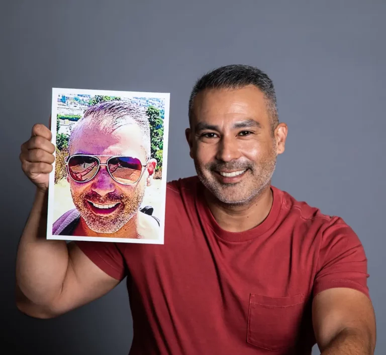 Edgar Silva: a Hair Loss Treatment success