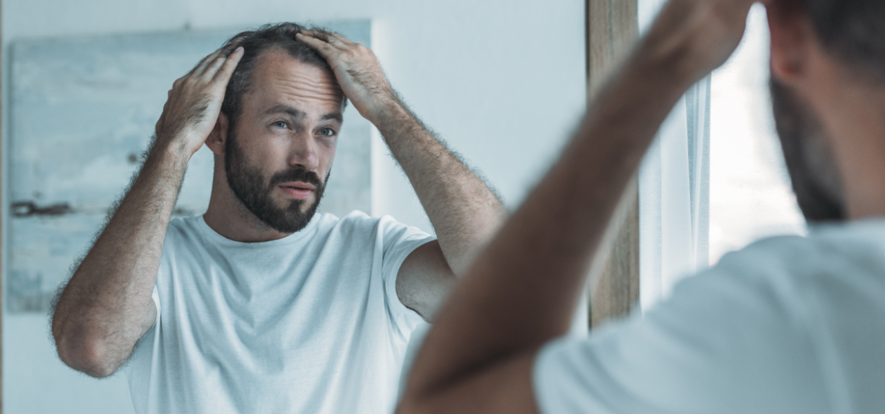 hair-loss-treatments-101