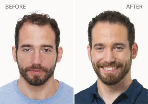 Gordon M Before and After