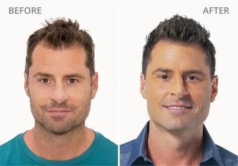 Jeff M. Before and After