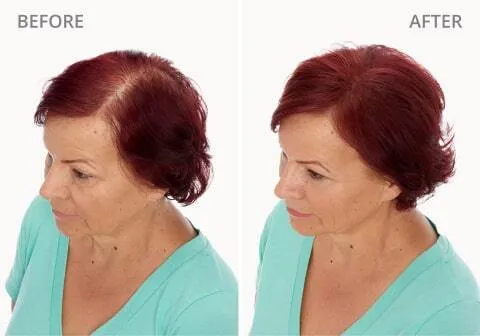 Maria S. Before and After