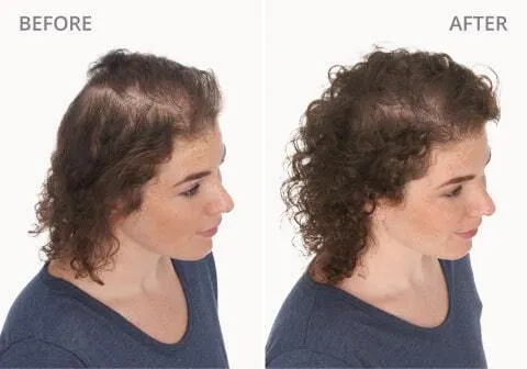 Stephanie H. Before and After