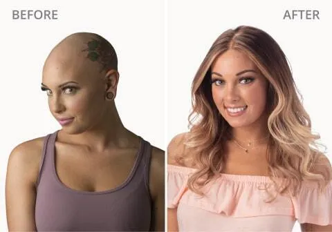 Isabelle O Before and After