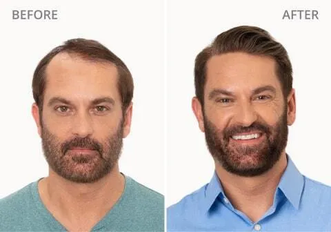 Tyler Before and After