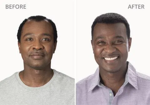 William Before and After