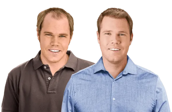 richard b before and after