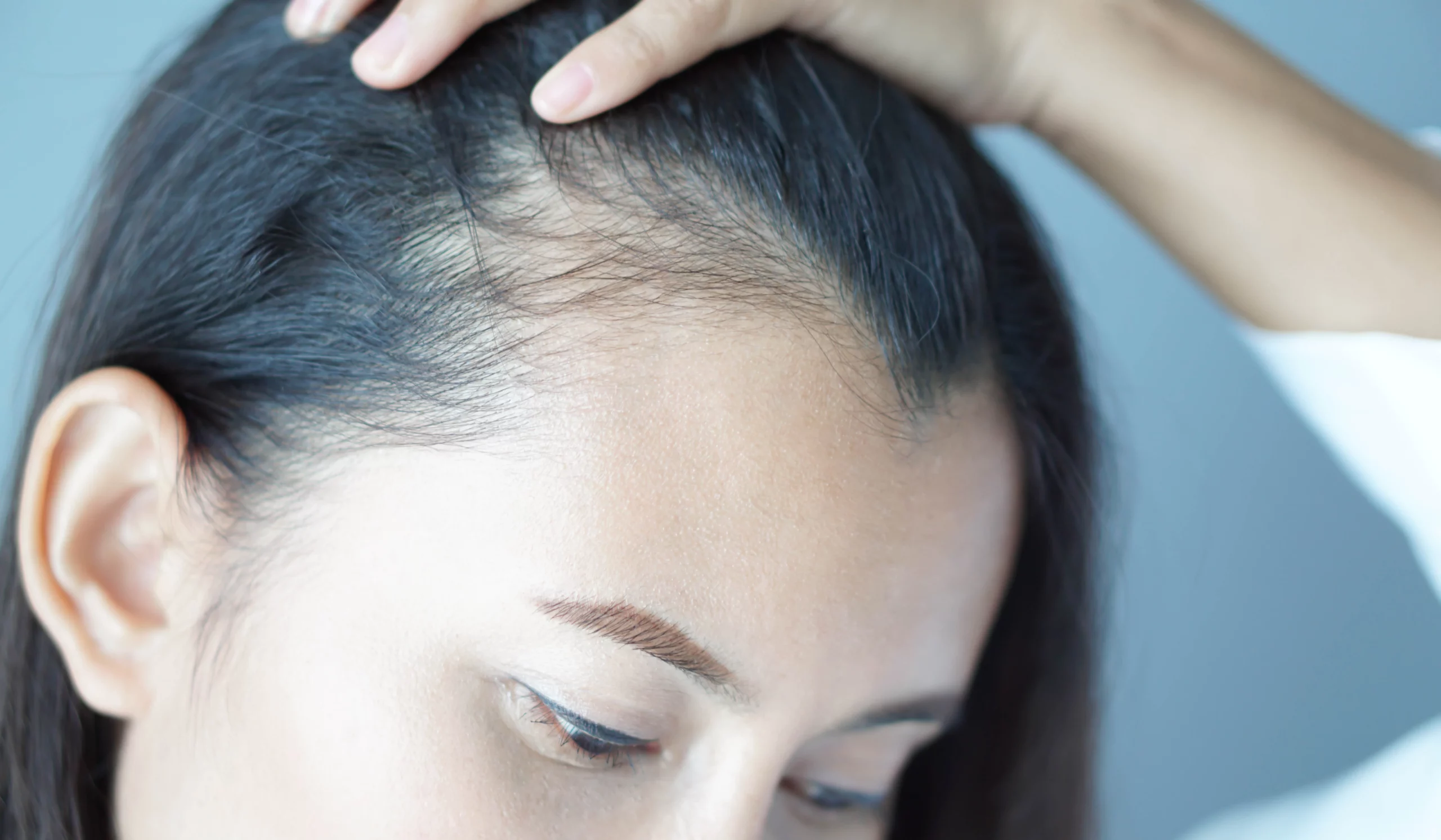 does-dry-shampoo-cause-hair-loss