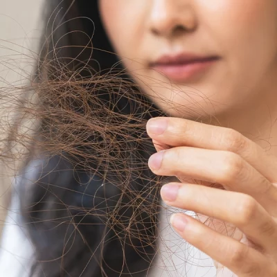 The Root Causes of Hair Loss